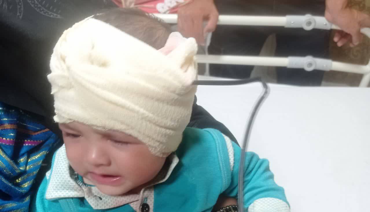 خارج کردن میله فلزی از سر نوزاد 8 ماهه در کازرون