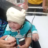 خارج کردن میله فلزی از سر نوزاد 8 ماهه در کازرون