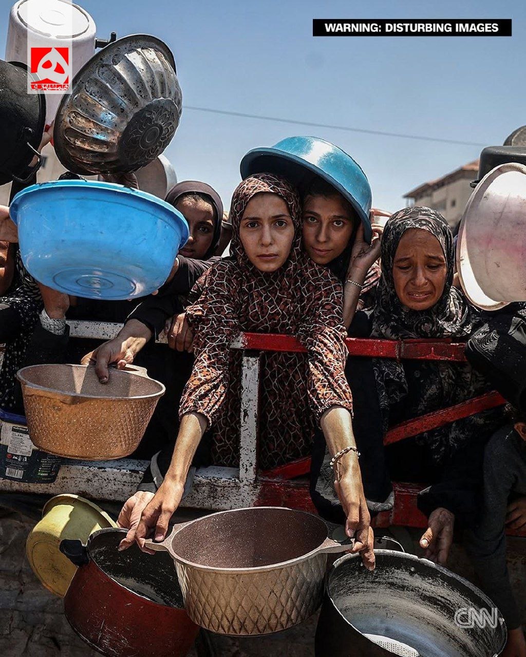 عکس/ تصاویری دردناک از گرسنگی مردم غزه