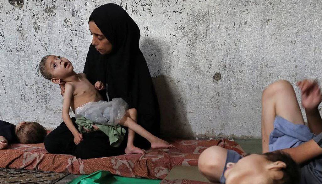 گزارش تصویری دردناک رسانه آمریکایی از وضعیت گرسنگی در غزه