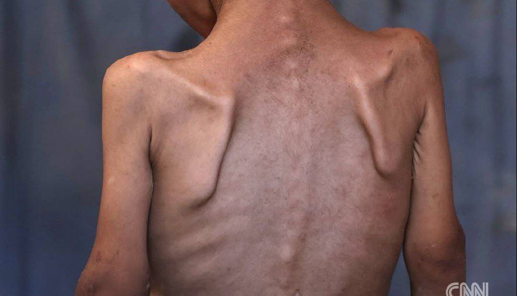 گزارش تصویری دردناک رسانه آمریکایی از وضعیت گرسنگی در غزه