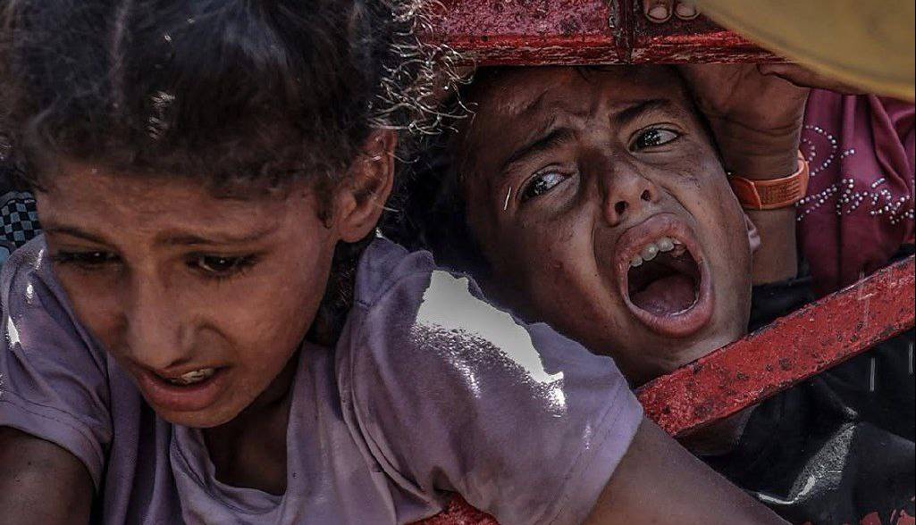 مدیر امداد پزشکی غزه: 17 هزار کودک از سوءتغذیه شدید رنج می‌برند