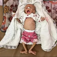 شهادت نوزاد ۶ ماهه فلسطینی بر اثر گرسنگی