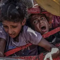 مدیر امداد پزشکی غزه: 17 هزار کودک از سوءتغذیه شدید رنج می‌برند