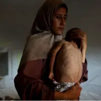 سازمان ملل: قحطی در غزه عامدانه است
