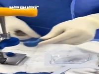 ویدئویی جالب از سرِهم کردن مفصل مصنوعی لگن