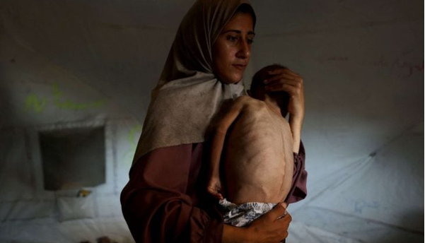 سازمان ملل: قحطی در غزه عامدانه است
