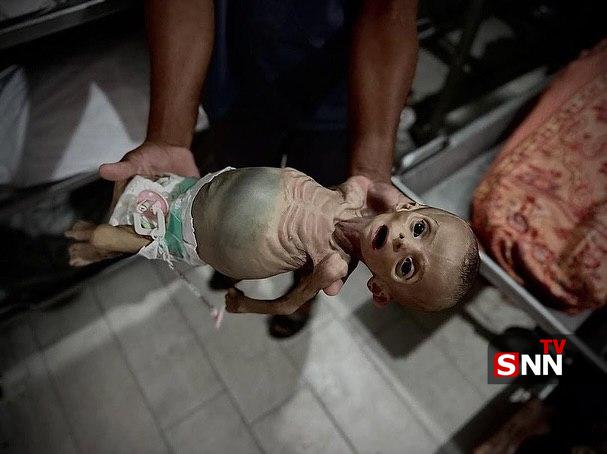 عکس/ تصاویری دردناک از شهادت کودک فلسطینی بر اثر قحطی شدید