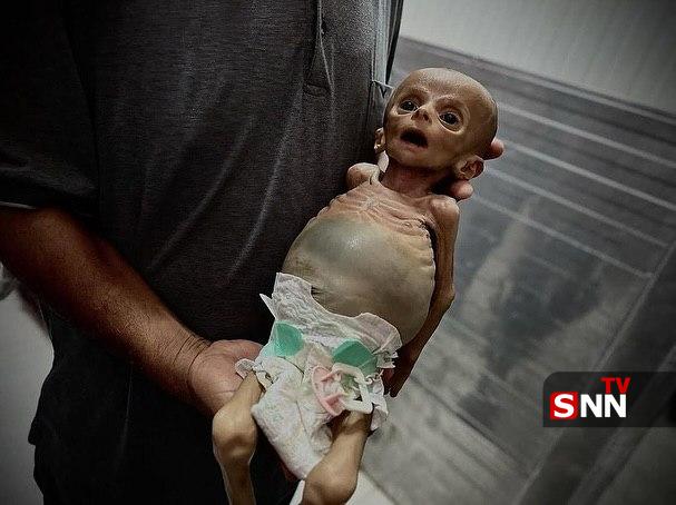عکس/ تصاویری دردناک از شهادت کودک فلسطینی بر اثر قحطی شدید