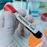 آخرین وضعیت واکسیناسیون هپاتیت در ایران