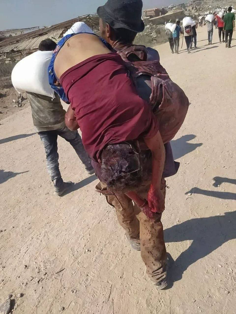 عکس/ پدری که پیکر پسر شهیدش را به دوش می‌کشد