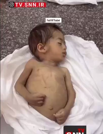 شهادت جانسوز نوزاد فلسطینی در اثر گرسنگی