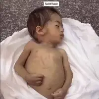 شهادت جانسوز نوزاد فلسطینی در اثر گرسنگی  