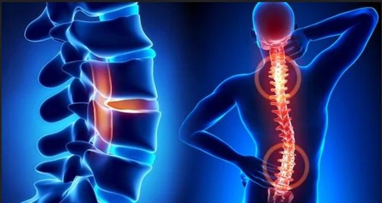 تنگی کانال می‌تواند بی علامت باشد!