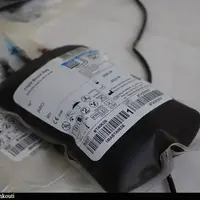 شناسایی ۱۰۰۰ نفر با گروه خونی نادر در کشور