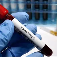 روند خاموش و تدریجی هپاتیت C/ضرورت تشخیص به موقع این بیماری