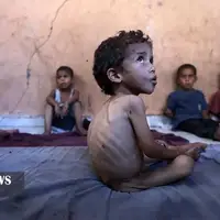 عکس/ غزه در چنگال بحران گرسنگی و مرگ