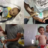 شهادت یک نوزاد فلسطینی و مرگ تدریجی نوزادی دیگر در غزه