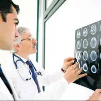تشخیص زودهنگام سکته مغزی با فناوری جدید