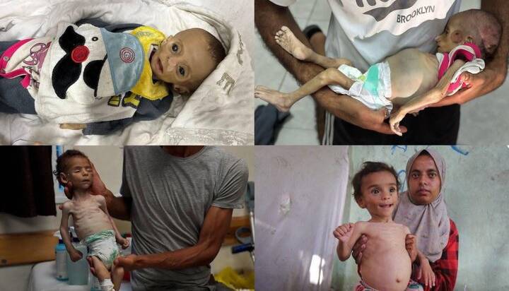 شهادت یک نوزاد فلسطینی و مرگ تدریجی نوزادی دیگر در غزه