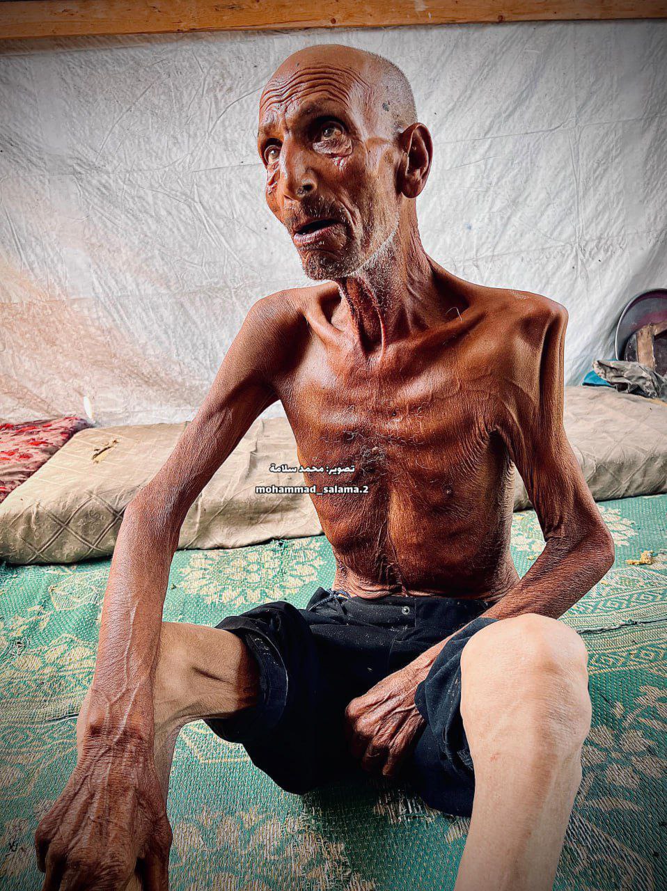 عکس/ تصاویری هولناک از تاثیرات گرسنگی بر موذن مسجد صحابه در جنوب غزه   