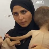 غزه؛ دست خالی مادران و پزشکان برابر گرسنگی و بیماری کودکان