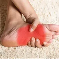 داغی و سوزش کف پا نشانه چیست؟