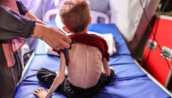 مرگ در سکوت: نوزادان غزه از گرسنگی می‌میرند، جهان چه می‌کند؟