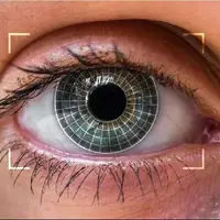 تغییر رنگ چشم؛ یک جراحی زیبایی پرطرفدار / توصیه یک چشم‌پزشک به متقاضیان