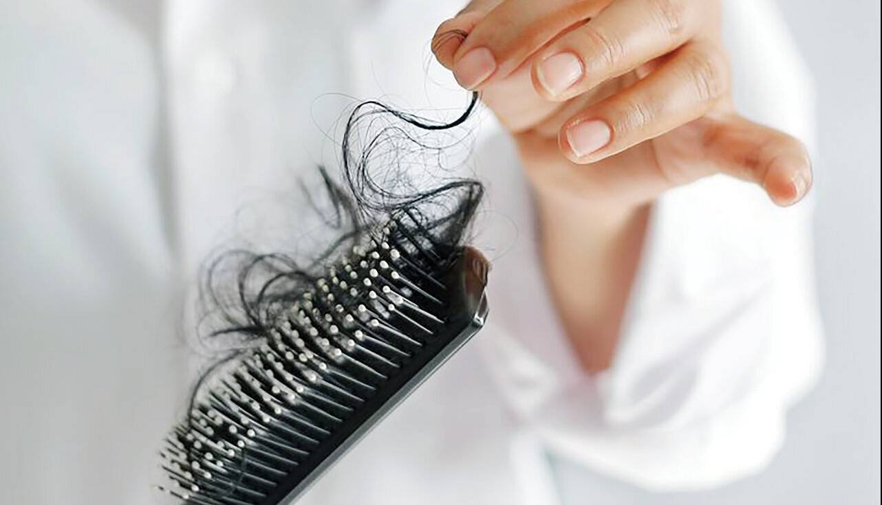 نسخه طب سنتی برای رفع ریزش مو