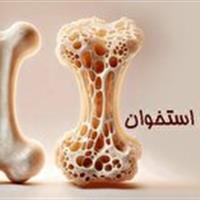 در دهه چهارم زندگی مراقب پوکی استخوان باشید
