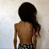کاریکاتور تلخ نشریه ایتالیایی در واکنش به گرسنگان غزه