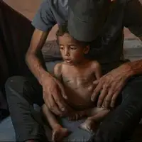 شهادت ۲۲۷ نفر در غزه به دلیل گرسنگی و سوء تغذیه