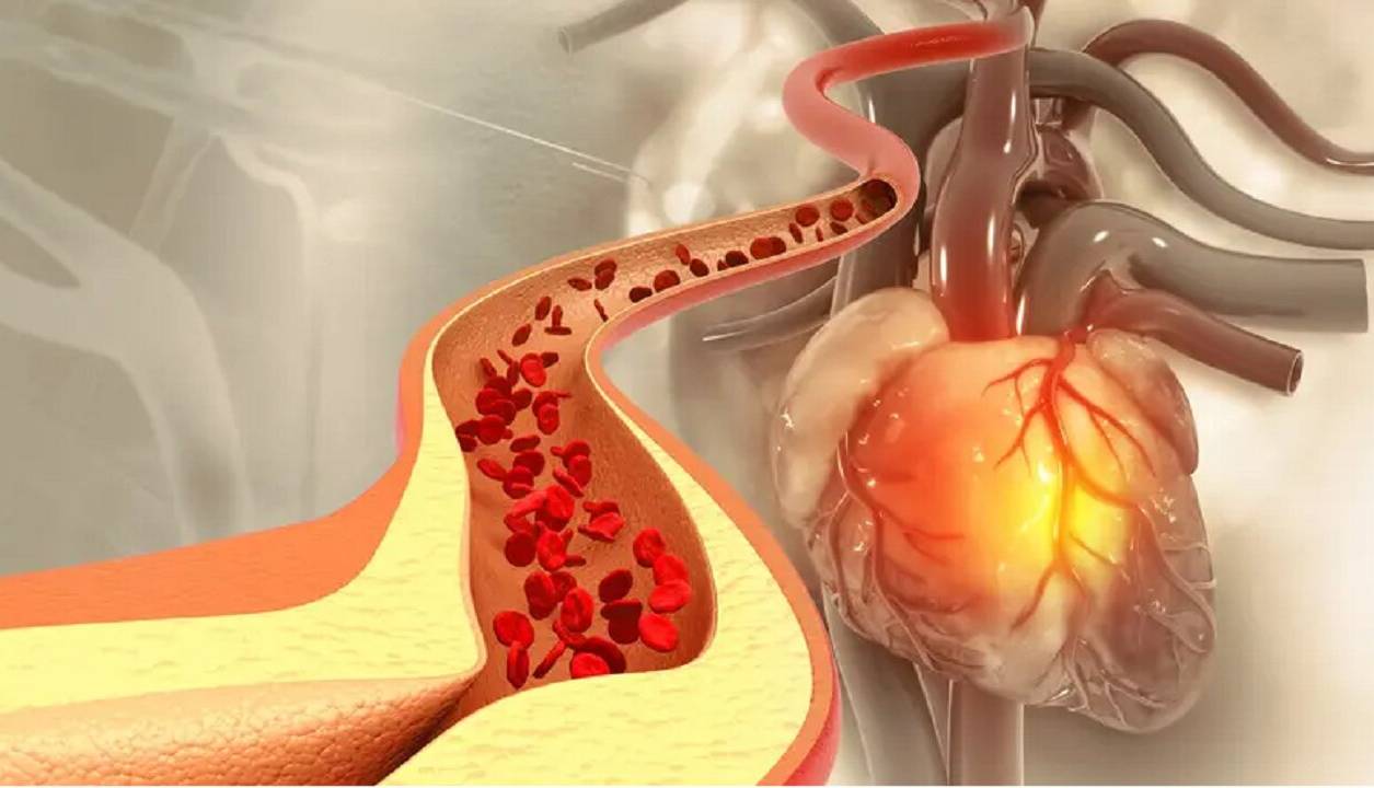 ادویه‌ای که کلسترول خون را کاهش می‌دهد