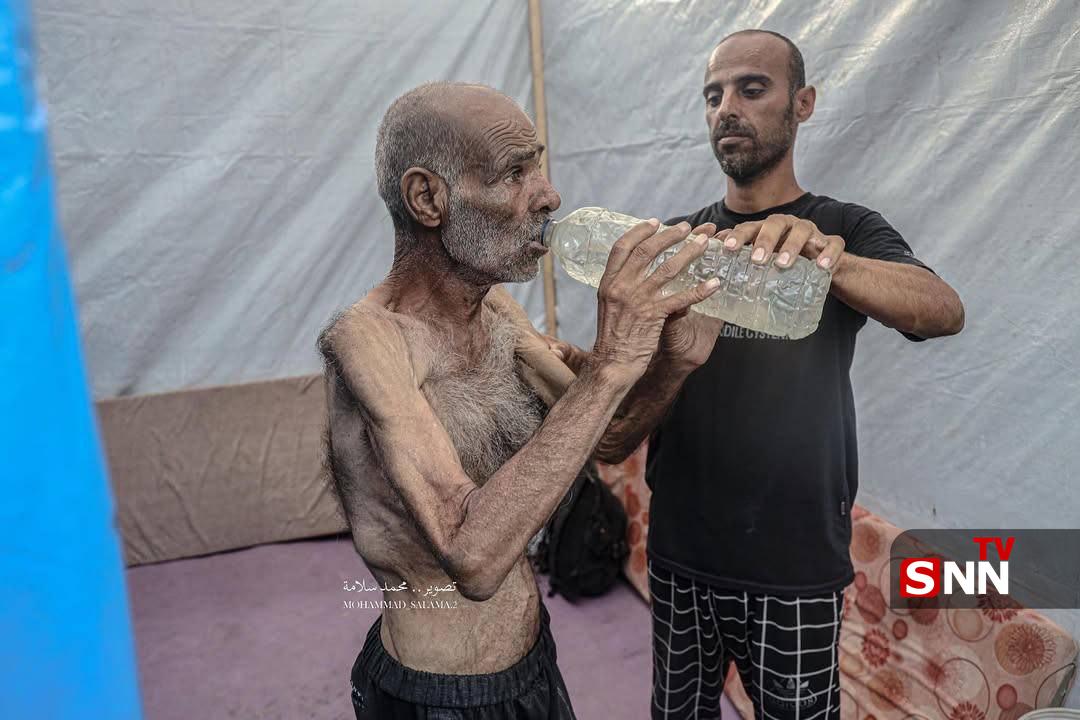 عکس/ وخامت حال سالمندان فلسطینی در پی ادامه محاصره و جنگ گرسنگی در غزه