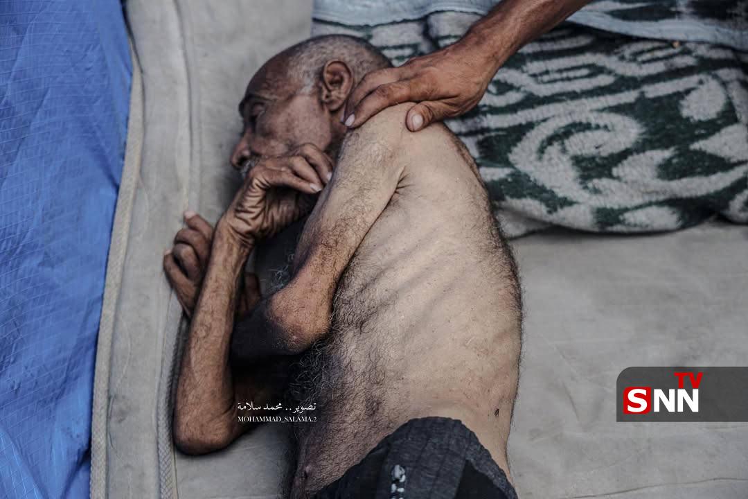 عکس/ وخامت حال سالمندان فلسطینی در پی ادامه محاصره و جنگ گرسنگی در غزه