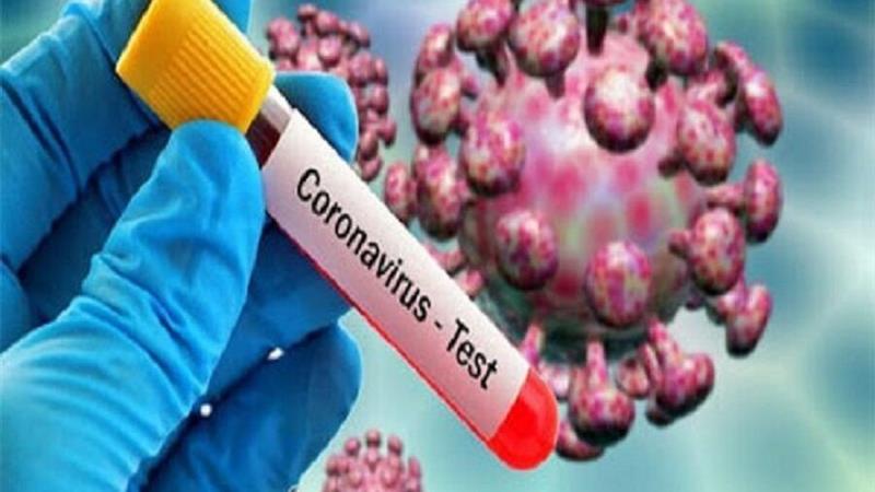 تست کرونای شماری از زائران یزدی اربعین، مثبت اعلام شد