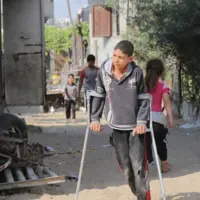۳۰ فلسطینی هر روز در غزه دچار معلولیت می‌شوند