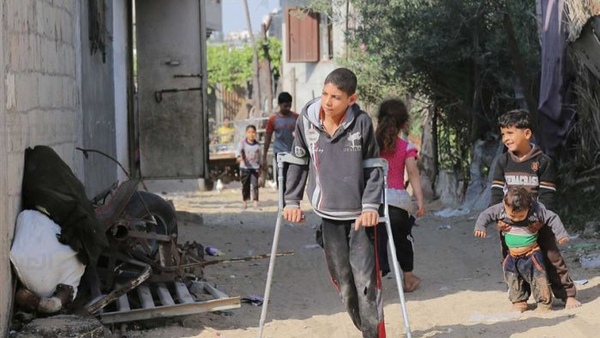 ۳۰ فلسطینی هر روز در غزه دچار معلولیت میشوند