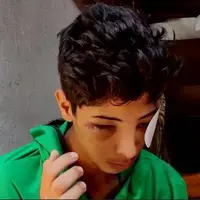 چشم‌های از دست رفته غزه؛ وقتی تک‌تیرانداز اسرائیلی نوجوان فلسطینی را هدف گرفت