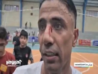 حرفهای ستاره فوتسال ایران با صورت زخمی!