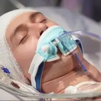 تهدید خاموش سرمایه انسانی؛ ضربه مغزی زندگی را متوقف می‌کند