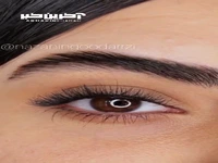 همه چیز درباره کاشت هیدن و نکات طلایی آن