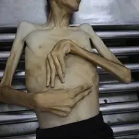 عکس/ تصاویری دردناک از شهادت جوان غزه‌ای بر اثر گرسنگی و محاصره 