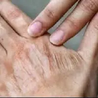 اشتباه‌های رایج در مراقبت روزانه از پوست
