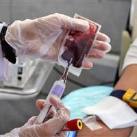 رونمایی از 3 محصول تخصصی حوزه خون‌شناسی/ رفع مشکل پالایش پلاسما تا 3 سال آینده