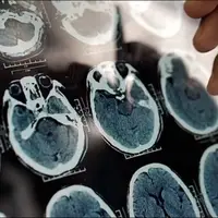 هر ۷ دقیقه یک ایرانی به این بیماری مبتلا می‌شود