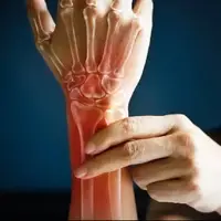 اقدامات لازم در زمان شکستگی دست 