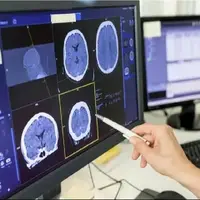 اوتیسم و ​​صرع مسیر مغزی مشترکی دارند