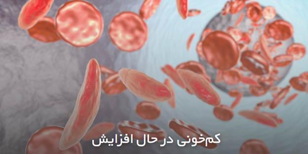 کمخونی در حال افزایش
